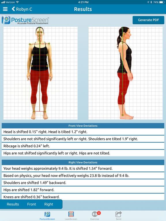 PostureScreen postural analysis showing front and side alignment measurements